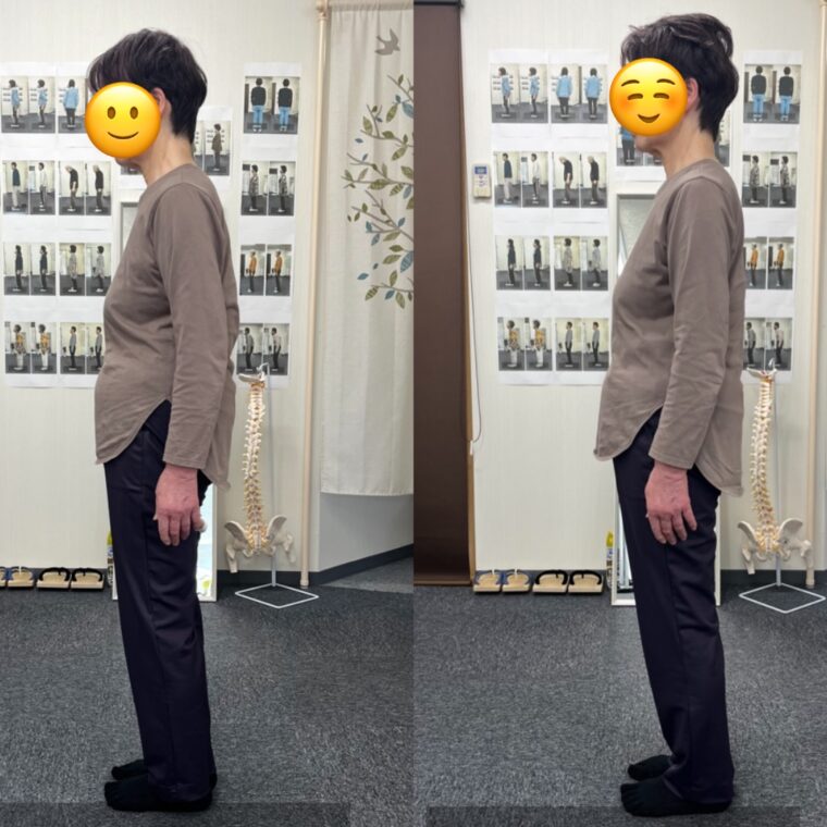 姿勢不良を放置すると