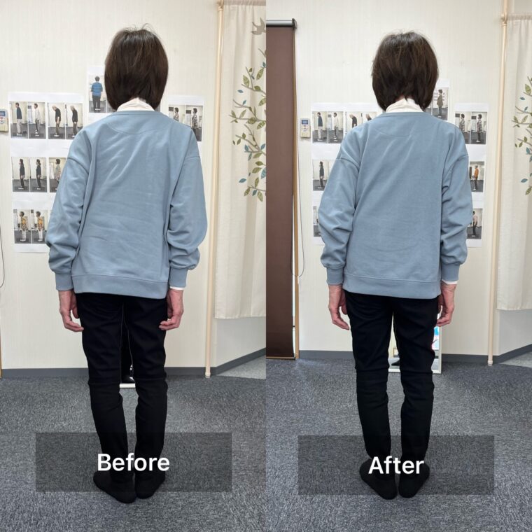 　「身体のゆがみがあると出る症状」