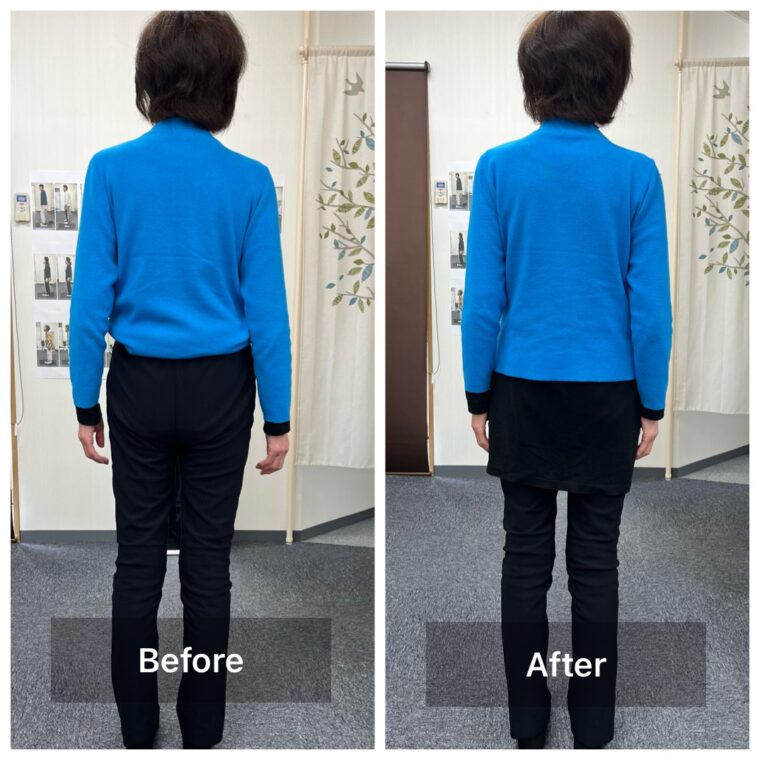 O脚、X脚と骨盤の関係について